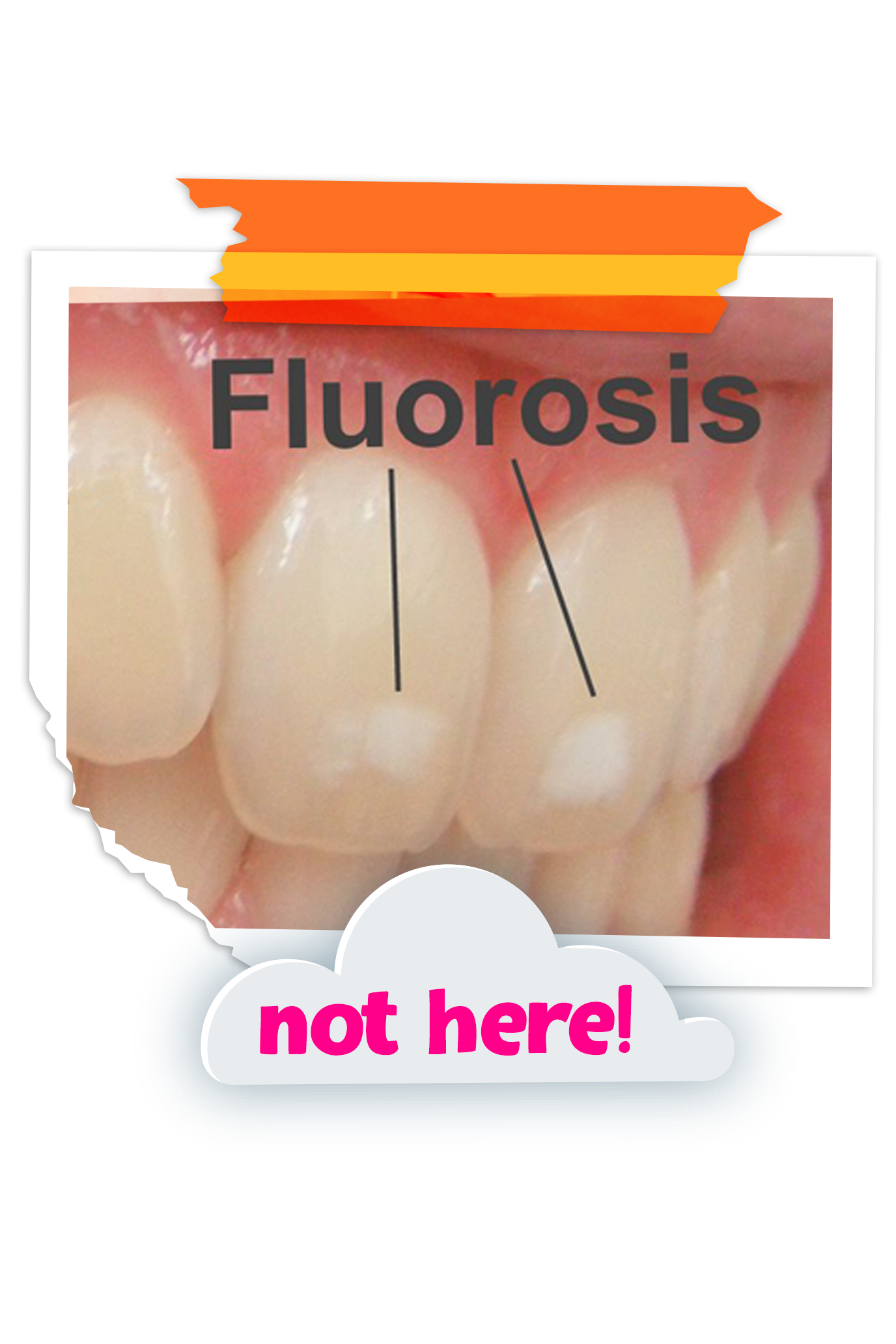 Fluorosis_Mobile_v1.png